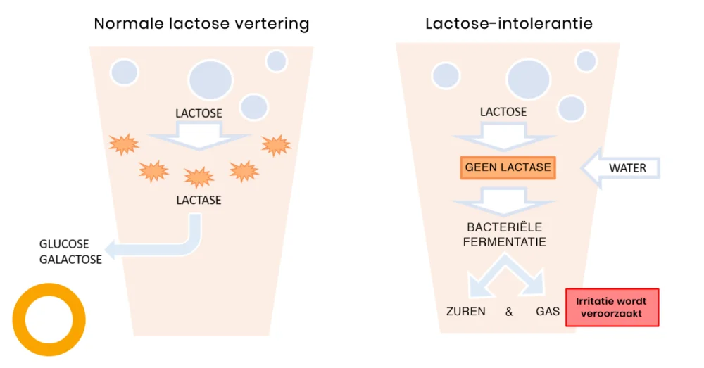 lactose-intolerantie-e1550312049517